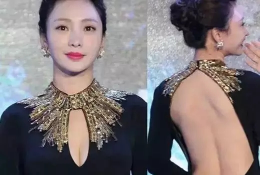皮膚衰老請(qǐng)選擇熱拉提美容儀器